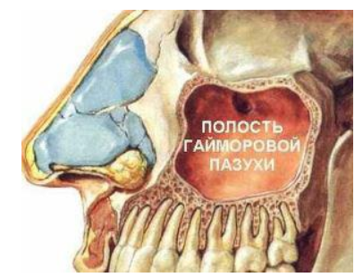гайморова пазуха гайморова пазуха